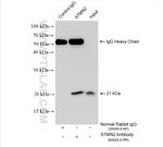 STMN2 Antibody in Immunoprecipitation (IP)