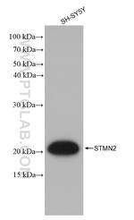 STMN2 Antibody in Western Blot (WB)