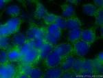 CYP7B1 Antibody in Immunocytochemistry (ICC/IF)