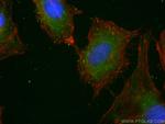 CYP7B1 Antibody in Immunocytochemistry (ICC/IF)