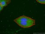 CYP7B1 Antibody in Immunocytochemistry (ICC/IF)