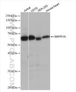BMPR1A Antibody in Western Blot (WB)