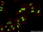 RORA Antibody in Immunocytochemistry (ICC/IF)