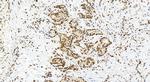 KHSRP Antibody in Immunohistochemistry (Paraffin) (IHC (P))