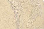 EIF2S1 Antibody in Immunohistochemistry (Paraffin) (IHC (P))