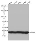 EIF2S1 Antibody in Western Blot (WB)