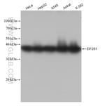 EIF2S1 Antibody in Western Blot (WB)
