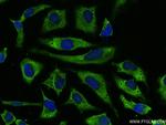 EIF2S1 Antibody in Immunocytochemistry (ICC/IF)