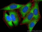 EIF2S1 Antibody in Immunocytochemistry (ICC/IF)