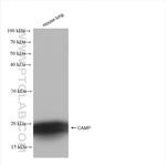 CAMP Antibody in Western Blot (WB)