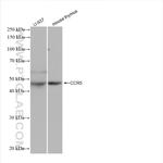CCR5 Antibody in Western Blot (WB)