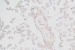 PDGFR beta Antibody in Immunohistochemistry (Paraffin) (IHC (P))