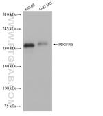 PDGFR beta Antibody in Western Blot (WB)