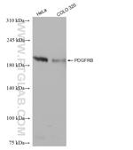 PDGFR beta Antibody in Western Blot (WB)
