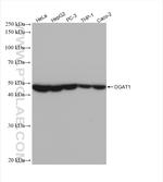 DGAT1 Antibody in Western Blot (WB)