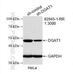 DGAT1 Antibody in Western Blot (WB)