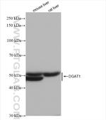 DGAT1 Antibody in Western Blot (WB)