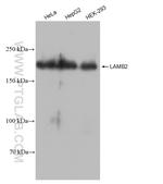 LAMB2 Antibody in Western Blot (WB)
