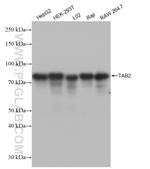 TAB2 Recombinant Rabbit Monoclonal Antibody (230118G2)
