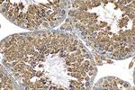 GPX4 Antibody in Immunohistochemistry (Paraffin) (IHC (P))