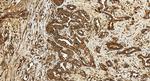 uPAR, PLAUR Antibody in Immunohistochemistry (Paraffin) (IHC (P))