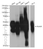 uPAR, PLAUR Antibody in Western Blot (WB)