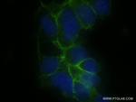 CLDN16 Antibody in Immunocytochemistry (ICC/IF)