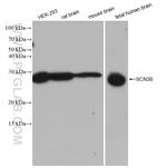 SCN3B Antibody in Western Blot (WB)