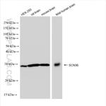SCN3B Antibody in Western Blot (WB)