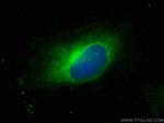 RAB32 Antibody in Immunocytochemistry (ICC/IF)
