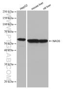 NAGS Antibody in Western Blot (WB)