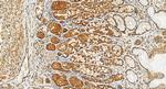 PGM5 Antibody in Immunohistochemistry (Paraffin) (IHC (P))