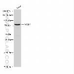 ACAP1 Antibody in Western Blot (WB)