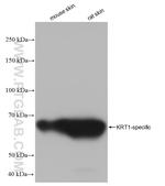 Cytokeratin 1 Antibody in Western Blot (WB)