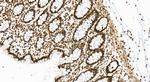 HMGB1 Antibody in Immunohistochemistry (Paraffin) (IHC (P))
