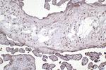 RAN Antibody in Immunohistochemistry (Paraffin) (IHC (P))