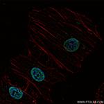 ARID1B Antibody in Immunocytochemistry (ICC/IF)
