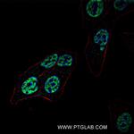 POU4F3 Antibody in Immunocytochemistry (ICC/IF)