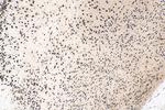 POU4F3 Antibody in Immunohistochemistry (Paraffin) (IHC (P))