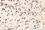 POU4F3 Antibody in Immunohistochemistry (Paraffin) (IHC (P))