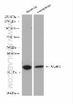 POU4F3 Antibody in Western Blot (WB)