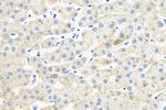 OGDHL Antibody in Immunohistochemistry (Paraffin) (IHC (P))