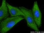 AFP Antibody in Immunocytochemistry (ICC/IF)