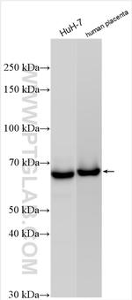 AFP Antibody in Western Blot (WB)