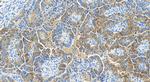 RILP Antibody in Immunohistochemistry (Paraffin) (IHC (P))