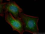FOXO1 Antibody in Immunocytochemistry (ICC/IF)