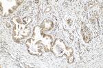 FOXO1 Antibody in Immunohistochemistry (Paraffin) (IHC (P))