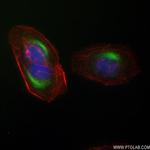 CCDC23 Antibody in Immunocytochemistry (ICC/IF)