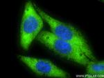 PCSK9 Antibody in Immunocytochemistry (ICC/IF)