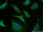 MTAP Antibody in Immunocytochemistry (ICC/IF)